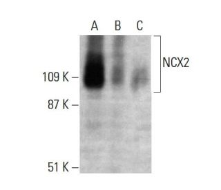 NCX2 Antibody (E-1) - Western Blotting - Image 364778SAM Transcription Activation: SAM system utilizing dCas9-VP64, MS2-P65-HSF1, and sgRNA for precise gene transcription activation.