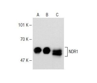 NDR1 Antibody (YJ-7) - Western Blotting - Image 148659 
