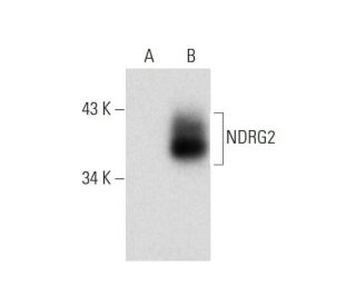 NDRG2 Antibody (C-5) - Western Blotting - Image 138517