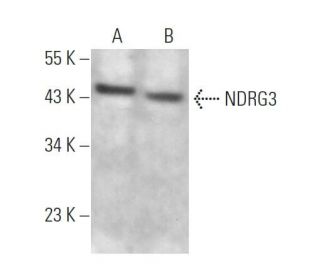 NDRG3 Antibody (H-11) - Western Blotting - Image 373282Each CRISPR/Cas9 Knockout (KO) Plasmid product consists of a pool of 3 plasmids designed to ensure identification and cleavage of a specific gene for maximum knockout efficiency. Each plasmid encodes a unique 20 nt sequence derived from the GeCKO (v2) library.