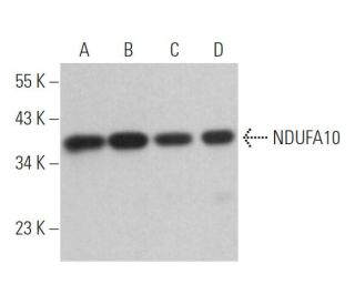 NDUFA10 Antibody (F-4) - Western Blotting - Image 364040 