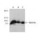 NDUFA5 Antibody (E-5) - Western Blotting - Image 377393
