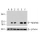 NDUFA8-Antikörper (C-6): sc-398097. Western Blot Analyse der NDUFA8 Expression in unbehandelten HeLa- (A), chemisch behandelten HeLa- (B, C), unbehandelten K-562- (D), chemisch behandelten K-562- (E) und HCT-116 (F) Gesamtzelllysaten. β-Actin (C4): sc-47778 als Ladekontrolle verwendet. Verwendetes Nachweisreagenz: m-IgG Fc BP-HRP: sc-525409. NDUFA8 Antibody (C-6) - Western Blotting - Image 415367
