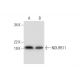 NDUFB11 Antibody (E-2) - Western Blotting - Image 295732