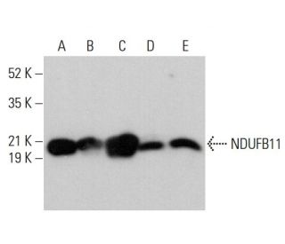 NDUFB11 Antibody (E-2) - Western Blotting - Image 377389 