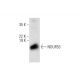 NDUFB3 Antibody (G-9) - Western Blotting - Image 301519