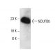 NDUFB6 Antibody (B-2) - Western Blotting - Image 387952 