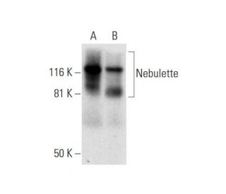 Nebulette Antibody (E-12) - Western Blotting - Image 298647 