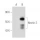 Nectin 2 Antibody (502-57) - Western Blotting - Image 40863