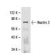 Nectin 3 Antibody (N3.81.6) - Western Blotting - Image 61233