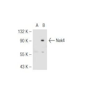 Nek4 Antibody (2631C1a) - Western Blotting - Image 51341 