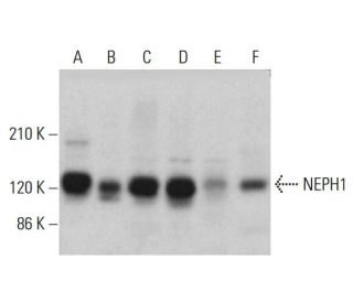 NEPH1 Antibody (F-6) - Western Blotting - Image 382854 
