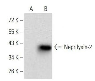 Neprilysin-2 Antibody (2D2H5) - Western Blotting - Image 358326 