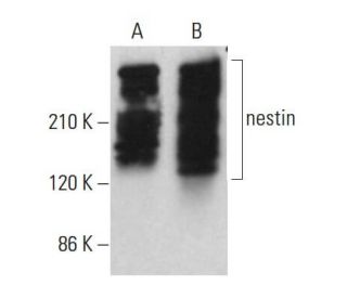 nestin Antibody (2Q178) - Western Blotting - Image 380575 