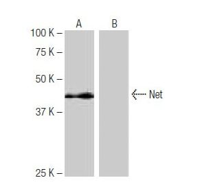 Net Antibody (11G9) - Western Blotting - Image 65015Each CRISPR/Cas9 Knockout (KO) Plasmid product consists of a pool of 3 plasmids designed to ensure identification and cleavage of a specific gene for maximum knockout efficiency. Each plasmid encodes a unique 20 nt sequence derived from the GeCKO (v2) library.