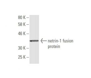 netrin-1 Antibody (5H8) - Western Blotting - Image 349001