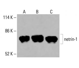 netrin-1 Antibody (A-7) - Western Blotting - Image 416481 