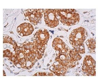 ErbB2/HER2 Antibody (0.N.211) - Immunohistochemistry - Image 352329 