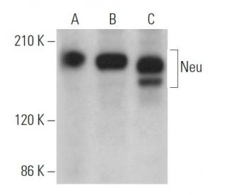 ErbB2/HER2 Antibody (3B5) - Western Blotting - Image 362025 