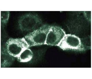 ErbB2/HER2 Antibody (42) - Immunofluorescence - Image 133603 