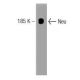 ErbB2/HER2 Antibody (42) - Western Blotting - Image 127463