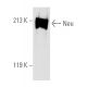 ErbB2/HER2 Antibody (9G6) - Western Blotting - Image 157372