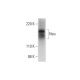 ErbB2/HER2 Antibody (C-12) - Western Blotting - Image 297827