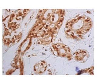 ErbB2/HER2 Antibody (C-3) - Immunohistochemistry - Image 352332 