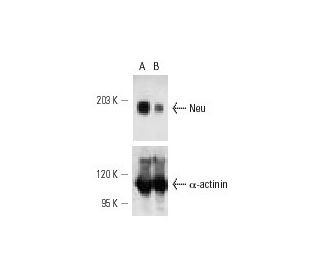 Neu siRNA (h): sc-29405. Western blot analysis of Neu expression in non-transfected control (A) and Neu siRNA transfected 
