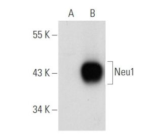 Neu1 Antibody (F-8) - Western Blotting - Image 109092The Double Nickase Plasmid features a U6 promoter for sgRNA expression, a 20 nt targeting sequence, and a gRNA scaffold to guide Cas9n. It includes a CBh promoter for Cas9n (D10A) and puromycin resistance, GFP for transfection verification, and nuclear localization signals (NLS). The 2A peptide allows co-expression of Cas9n and Puro from a single promoter, enabling precise genome editing with reduced off-target effects.