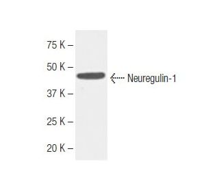 Neuregulin-1/NRG1 Antibody (k1G13) - Western Blotting - Image 62771