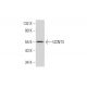 Neuro-2A Whole Cell Lysate: sc-364185. Western blot analysis of GCNT3...