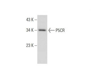 Neuro-2A Whole Cell Lysate: sc-364185. Western blot analysis of P5CR... 