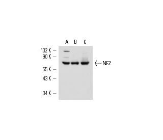Neurofibromin 2/NF2/Merlin Antibody (E-2) - Western Blotting - Image 15041
