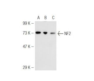 Neurofibromin 2/NF2/Merlin Antibody (E-2) - Western Blotting - Image 45514