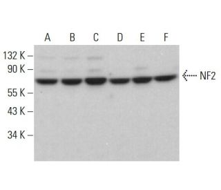 Neurofibromin 2/NF2/Merlin Antibody (E-2) - Western Blotting - Image 380424