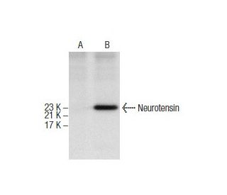 Neurotensin Antibody (E-5) - Western Blotting - Image 157400SAM Transcription Activation: SAM system utilizing dCas9-VP64, MS2-P65-HSF1, and sgRNA for precise gene transcription activation.