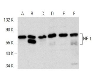 NF-1 Antibody (A-12) - Western Blotting - Image 356644 