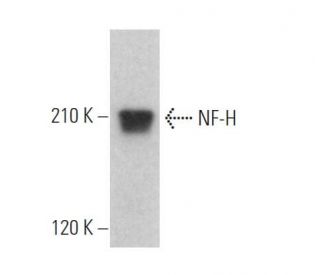 NF-H Antibody (2D2) - Western Blotting - Image 372863 