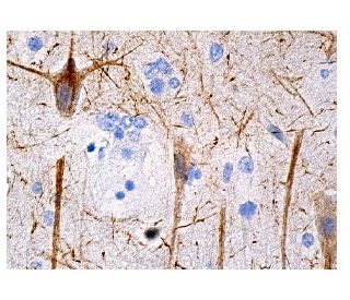 NF-H Antibody (A-12) - Immunohistochemistry - Image 157938 