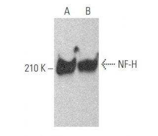 NF-H Antibody (D-9) - Western Blotting - Image 355611 