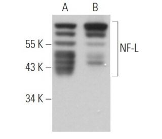 NF-L Antibody (3F285) - Western Blotting - Image 363642 