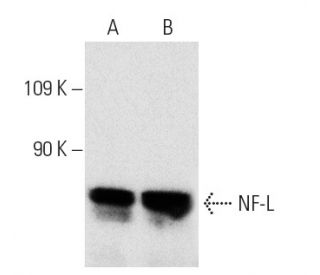NF-L Antibody (8A1) - Western Blotting - Image 4409 