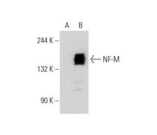 NF-M Antibody (2Q168) - Western Blotting - Image 128642