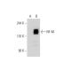 NF-M Antibody (2Q168) - Western Blotting - Image 128642