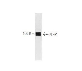 NF-M Antibody (3H11) - Western Blotting - Image 67337 