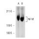 NF-M Antibody (NF-09) - Western Blotting - Image 12588