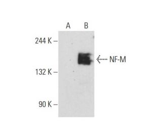 NF-M Antibody (NF-09) - Western Blotting - Image 128640 