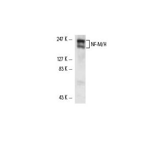 NF-M/H Antibody (RMdO-20) - Western Blotting - Image 9544 
