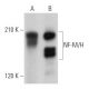 NF-M/H Antibody (RMdO-20) - Western Blotting - Image 362285
